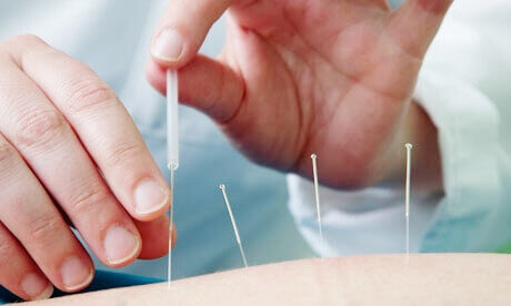 Chinese Medicine and Sports Injury Rehabilitation